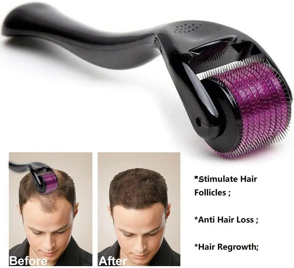 Derma Roller With 540 Micro Needles- For Men And Women